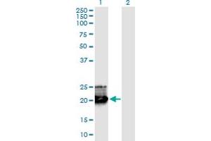 Western Blot analysis of GH1 expression in transfected 293T cell line by GH1 monoclonal antibody (M02), clone 8G6. (Growth Hormone 1 抗体  (AA 1-217))