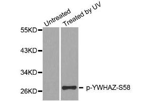 Western blot analysis of extracts from HeLa cells, using Phospho-YWHAZ-S58 antibody (ABIN2987575). (14-3-3 zeta 抗体  (pSer58))
