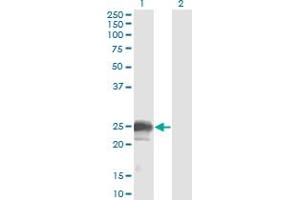 Western Blot analysis of NBL1 expression in transfected 293T cell line by NBL1 monoclonal antibody (M02), clone 1G5. (NBL1 抗体  (AA 21-130))