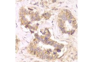Immunohistochemistry (IHC) image for anti-Catenin (Cadherin-Associated Protein), delta 1 (CTNND1) (AA 573-832) antibody (ABIN3022309)