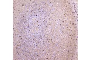 IHC analysis of WWOX using anti-WWOX antibody . (WWOX 抗体  (AA 1-245))