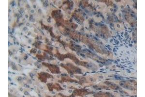 Immunohistochemistry (IHC) image for anti-Sprouty Homolog 1, Antagonist of FGF Signaling (SPRY1) (AA 112-303) antibody (ABIN7439549)