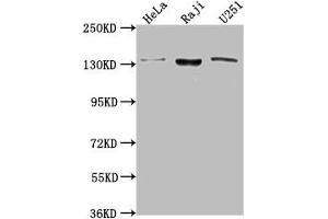 Western Blot Positive WB detected in: Hela whole cell lysate, Raji whole cell lysate, U251 whole cell lysate All lanes: LARS antibody at 1:2000 Secondary Goat polyclonal to rabbit IgG at 1/50000 dilution Predicted band size: 135, 129, 56 kDa Observed band size: 135 kDa (LARS 抗体  (AA 614-892))