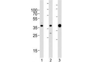 Western blot analysis of lysate from 1) MCF-7, 2) HeLa cell line and 3) human skeletal muscle tissue lysate using ALDOA antibody at 1:1000. (ALDOA 抗体  (AA 303-331))