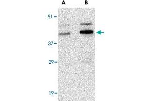 Western blot analysis of CCNO in human bladder tissue lysate with CCNO polyclonal antibody  at (A) 1 and (B) 2 ug/mL . (Cyclin O 抗体  (Internal Region))