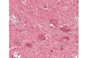 Immunohistochemistry (Paraffin-embedded Sections) (IHC (p)) image for anti-Cyclin-Dependent Kinase 14 (CDK14) (AA 67-96), (N-Term) antibody (ABIN390748)