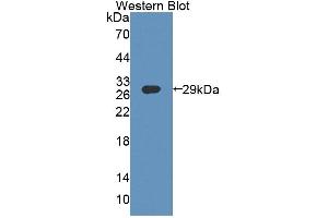 Western Blotting (WB) image for anti-ATP-Binding Cassette, Sub-Family F (GCN20), Member 1 (ABCF1) (AA 625-845) antibody (ABIN7444997)