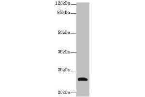 Western blot All lanes: YKT6 antibody at 12 μg/mL + A549 whole cell lysate Secondary Goat polyclonal to rabbit IgG at 1/10000 dilution Predicted band size: 23, 19 kDa Observed band size: 23 kDa (YKT6 抗体  (AA 10-195))