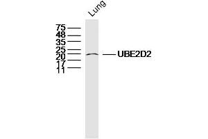 Mouse lung lysates probed with UBE2D2 Polyclonal Antibody, Unconjugated  at 1:300 dilution and 4˚C overnight incubation. (UBE2D2 抗体  (AA 31-130))