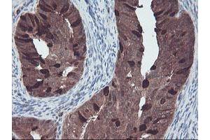 Image no. 2 for anti-RAB, Member of RAS Oncogene Family-Like 2A (RABL2A) antibody (ABIN1500575) (RABL2A 抗体)