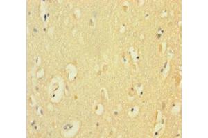 Immunohistochemistry of paraffin-embedded human brain tissue using ABIN7149094 at dilution of 1:100 (CYBB 抗体  (AA 283-570))