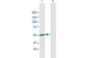 Western Blot analysis of TINF2 expression in transfected 293T cell line by TINF2 MaxPab polyclonal antibody. (TINF2 抗体  (AA 1-451))
