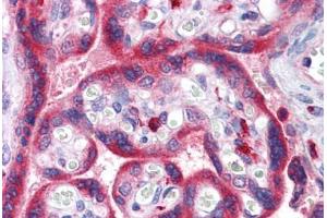 Anti-ADAM15 antibody IHC staining of human placenta. (ADAM15 抗体  (AA 1-225))