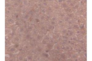 IHC-P analysis of Mouse Liver Tissue, with DAB staining. (alpha 2 Macroglobulin 抗体  (AA 1053-1214))
