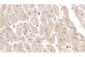 Detection of SHBG in Human Cardiac Muscle Tissue using Monoclonal Antibody to Sex Hormone Binding Globulin (SHBG) (SHBG 抗体  (AA 224-388))
