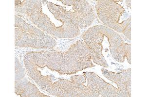 Immunohistochemistry (IHC) image for anti-Spectrin Beta, Non-Erythrocytic 1 (SPTBN1) (AA 2100-2150) antibody (ABIN7454694) (SPTBN1 抗体  (AA 2100-2150))
