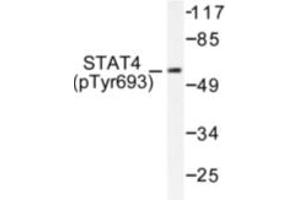 Image no. 1 for anti-Signal Transducer and Activator of Transcription 4 (STAT4) (pTyr693) antibody (ABIN318129) (STAT4 抗体  (pTyr693))