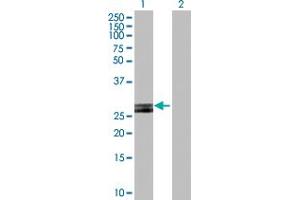 Western Blot analysis of HLA-DOB expression in transfected 293T cell line by HLA-DOB MaxPab polyclonal antibody. (HLA-DOB 抗体  (AA 1-273))