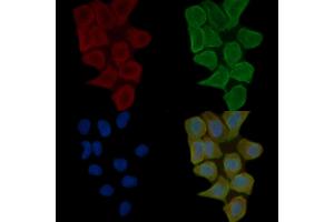 ABIN6263607 and ABIN6272359 staining Hela cells(30 min of UV treatment) by IF/ICC. (Neurexin 1 抗体  (N-Term))