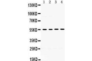 Western Blotting (WB) image for anti-Matrix Metallopeptidase 8 (Neutrophil Collagenase) (MMP8) (AA 120-157), (N-Term) antibody (ABIN3043883) (MMP8 抗体  (N-Term))