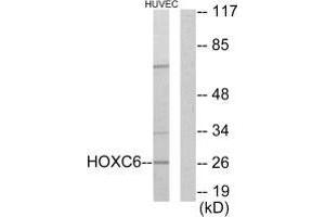 Western blot analysis of extracts from HUVEC cells, using HOXC6 antibody. (Homeobox C6 抗体  (C-Term))