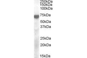 Western Blotting (WB) image for anti-Potassium Voltage-Gated Channel, KQT-Like Subfamily, Member 4 (KCNQ4) (Internal Region) antibody (ABIN2466703) (KCNQ4 抗体  (Internal Region))
