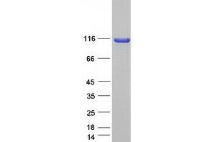 Western Blotting (WB) image for SCY1-Like 1 (SCYL1) (Transcript Variant B) protein (Myc-DYKDDDDK Tag) (ABIN2731512)