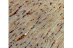 Used in DAB staining on fromalin fixed paraffin-embedded Heart tissue (Secretin 抗体  (AA 26-133))
