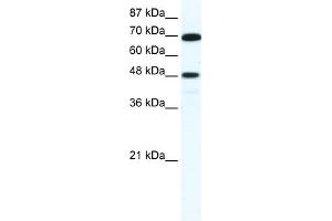 WB Suggested Anti-ZNF446 Antibody Titration:  5. (ZNF446 抗体  (N-Term))