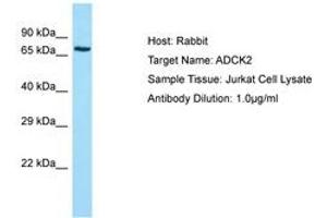 Image no. 1 for anti-AarF Domain Containing Kinase 2 (ADCK2) (AA 257-306) antibody (ABIN6749962) (ADCK2 抗体  (AA 257-306))