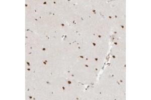 Immunohistochemical staining of human cerebral cortex with NHSL1 polyclonal antibody  shows strong nuclear positivity in neuronal cells at 1:200-1:500 dilution. (NHSL1 抗体)
