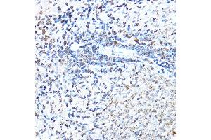 Immunohistochemistry (IHC) image for anti-Sp1 Transcription Factor (SP1) (AA 420-620) antibody (ABIN7270506)