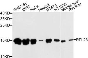 Western blot analysis of extracts of various cells, using RPL23 antibody. (RPL23 抗体)