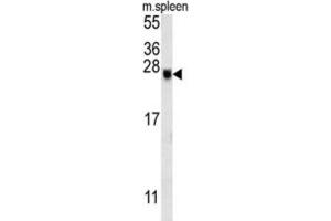 Western Blotting (WB) image for anti-EP300 Interacting Inhibitor of Differentiation 2 (EID2) antibody (ABIN3002400) (EID2 抗体)