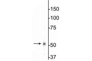 Western blot of mouse whole brain lysates showing specific immunolabeling of the ~55 kDa β1-subunit of the GABAA-R.