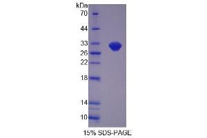 SDS-PAGE analysis of Mouse OVGP1 Protein. (OVGP1 蛋白)