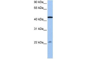 EWSR1 antibody used at 0. (EWSR1 抗体  (N-Term))