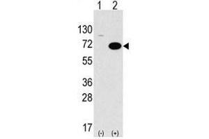 Image no. 1 for anti-serine threonine Kinase 39 (STK39) (C-Term) antibody (ABIN356942) (STK39 抗体  (C-Term))