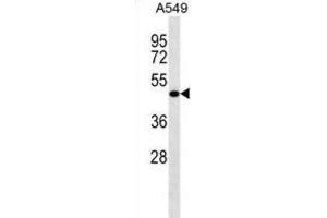 Western Blotting (WB) image for anti-Leucine Rich Repeat Containing 26 (LRRC26) antibody (ABIN2998660) (LRRC26 抗体)