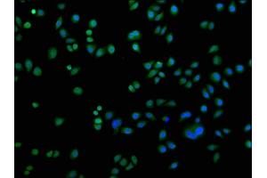 Immunofluorescence staining of Hela cells with ABIN7150833 at 1:200, counter-stained with DAPI. (DNM2 抗体  (AA 640-1119))