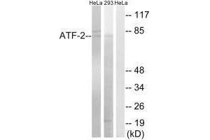 Western blot analysis of extracts from HeLa cells and 293 cells, using ATF-2 (Ab-472) antibody. (ATF2 抗体  (Ser472))