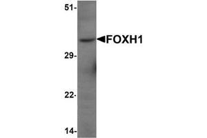 Western blot analysis of FOXH1 in human liver tissue lysate with FOXH1 Antibody  at 1 μg/mL (FOXH1 抗体  (N-Term))