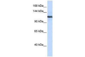 Western Blot showing PLA2G4B antibody used at a concentration of 1-2 ug/ml to detect its target protein. (PLA2G4B 抗体  (N-Term))
