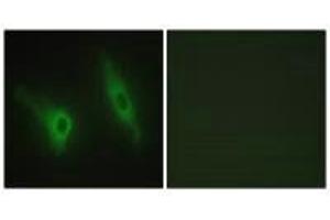 Immunofluorescence analysis of HeLa cells, using CKI-ε antibody. (CK1 epsilon 抗体)