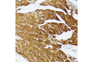Immunohistochemistry (IHC) image for anti-Cytochrome C Oxidase Assembly Homolog 15 (COX15) (AA 150-250) antibody (ABIN7266634)