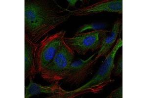 Immunofluorescence analysis of 3T3-L1 cells using CRK mouse mAb (green). (Crk 抗体)