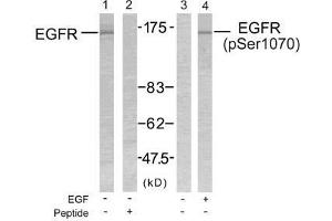 Western blot analysis of extract from SK-OV3 cells untreated or treated with EGF using EGFR (Ab-1070) antibody (E021073, Lane 1 and 2) and EGFR (phospho-Ser1070) antibody (E011080, Lane 3 and 4). (EGFR 抗体)