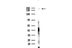 anti-C-Abl Oncogene 1, Non-Receptor tyrosine Kinase (ABL1) (pTyr245) antibody