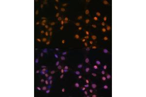 Immunofluorescence analysis of NIH/3T3 cells using c-Jun antibody (ABIN3020776, ABIN3020777, ABIN1513116 and ABIN6213718) at dilution of 1:100. (C-JUN 抗体  (AA 1-70))