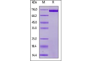 Human Siglec-2, His Tag on  under reducing (R) condition. (CD22 Protein (AA 20-687) (His tag))